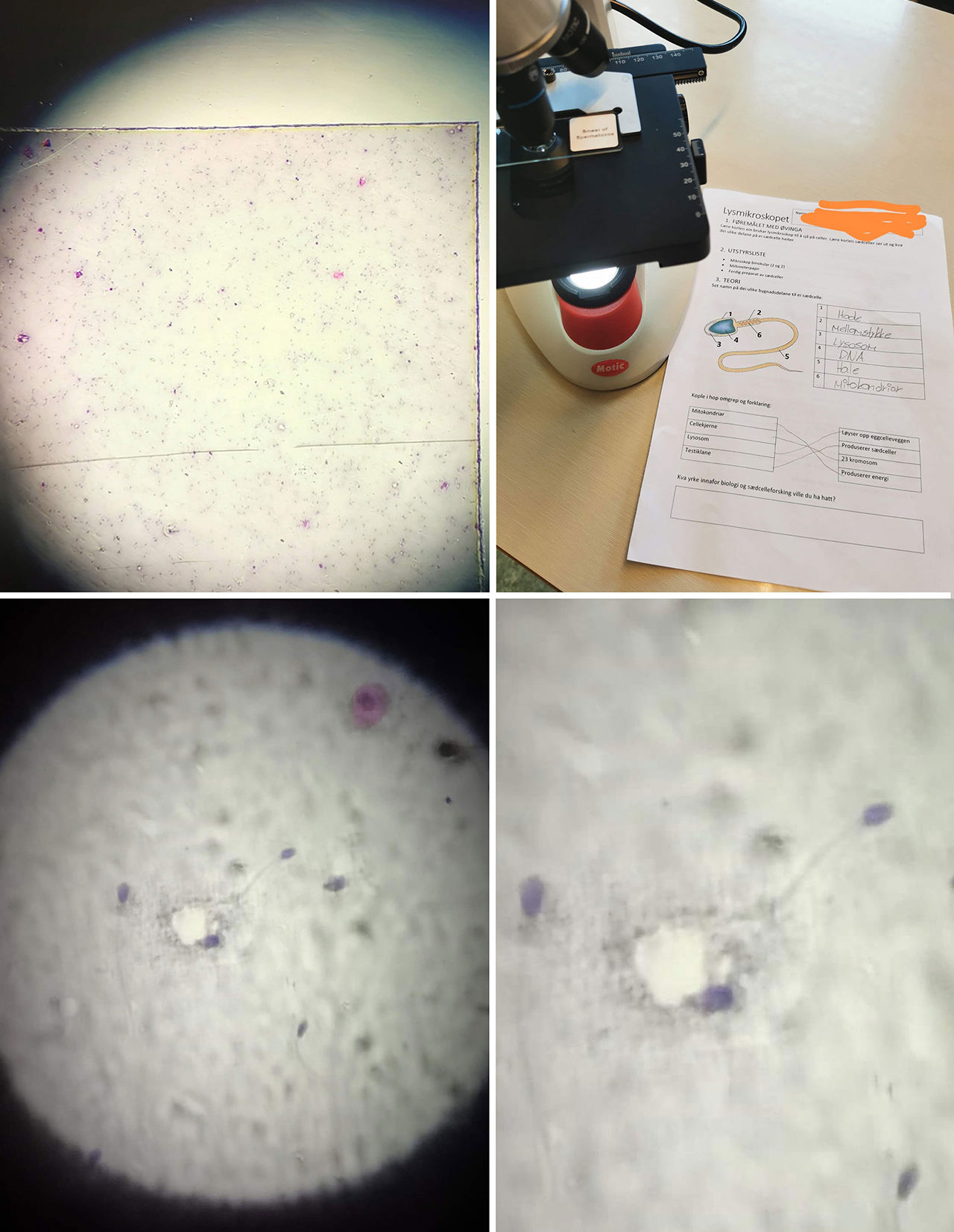 Noko pittelite som er eit stort biologisk fagfelt: Sædcella. Hospitantane ser på sædceller gjennom microskop.